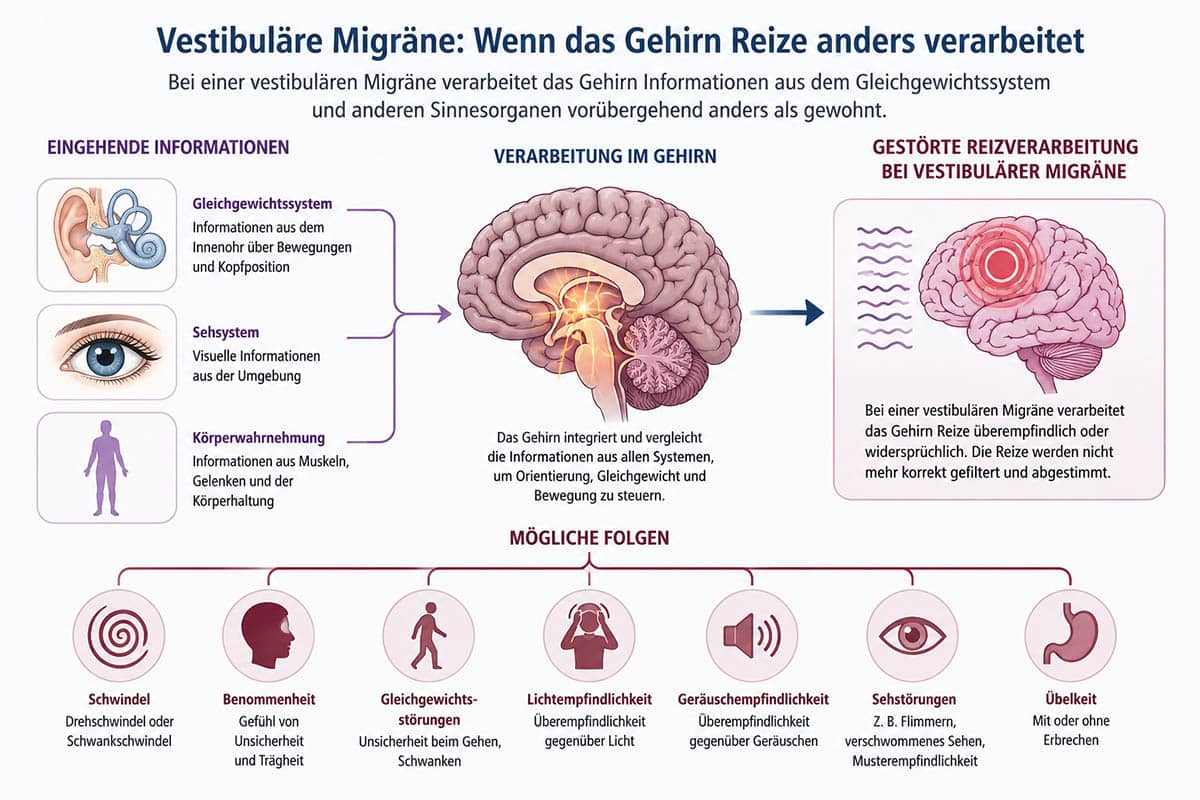 Grafik zur vestibulären Migräne mit veränderter Verarbeitung von Gleichgewichts-, Seh- und Körperinformationen im Gehirn