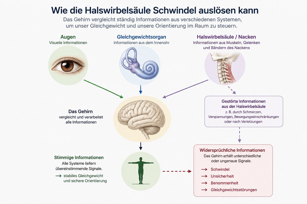 Grafik zur Entstehung von Schwindel durch die Halswirbelsäule. Das Gehirn verarbeitet Informationen aus Augen, Gleichgewichtsorgan und Nacken. Gestörte Informationen aus der Halswirbelsäule können Schwindel, Unsicherheit und Benommenheit auslösen.